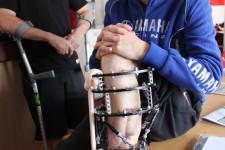 Ian Hunchinson with his badly broken leg & David Knight who is having hip surgery
